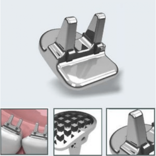 Tongue Tramers / LINGUAL SPUR MINI EDUCATOR / CONTROL DE HABITO / SET X 10 MORELLI